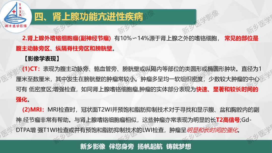影像PPT - 【PPT】肾上腺解剖及常见疾病诊断要点-35