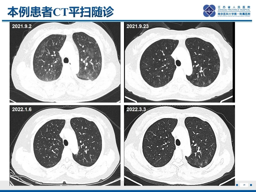 影像PPT - 【PPT】抗合成酶综合征相关间质性肺病-30