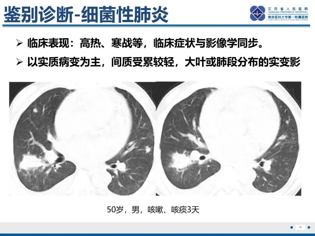 影像PPT - 【PPT】抗合成酶综合征相关间质性肺病-32