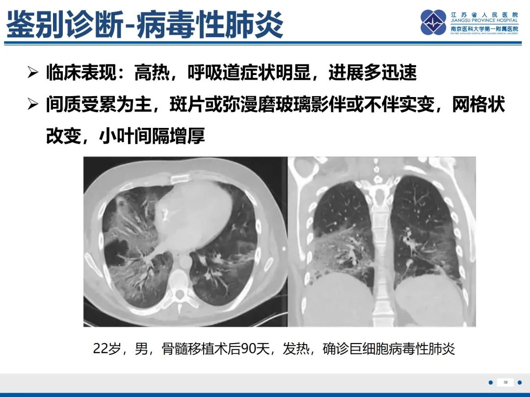 影像PPT - 【PPT】抗合成酶综合征相关间质性肺病-33