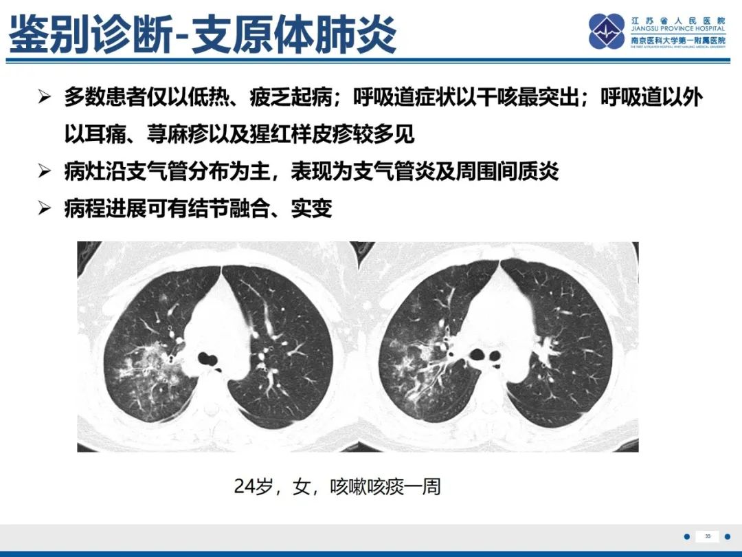 影像PPT - 【PPT】抗合成酶综合征相关间质性肺病-34