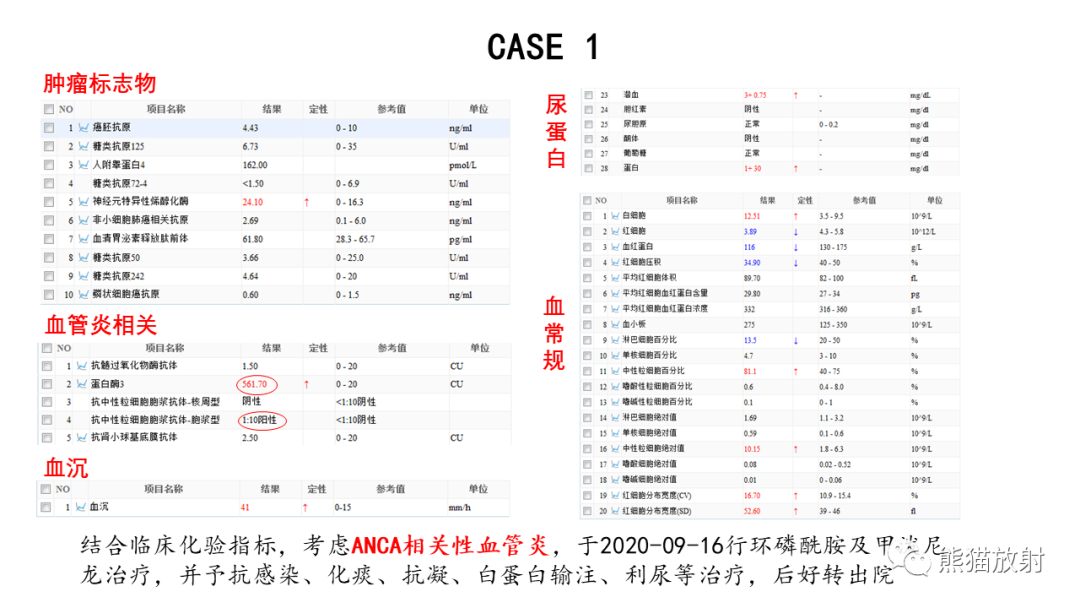 影像PPT - 【病例】ANCA相关性血管炎2例肺部CT影像-22