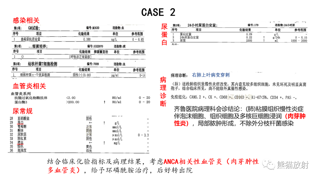 影像PPT - 【病例】ANCA相关性血管炎2例肺部CT影像-25
