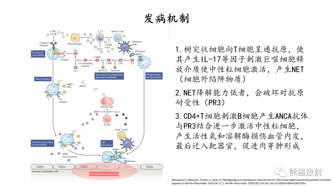 影像PPT - 【病例】ANCA相关性血管炎2例肺部CT影像-33