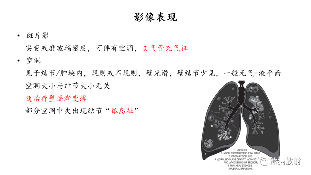 影像PPT - 【病例】ANCA相关性血管炎2例肺部CT影像-37