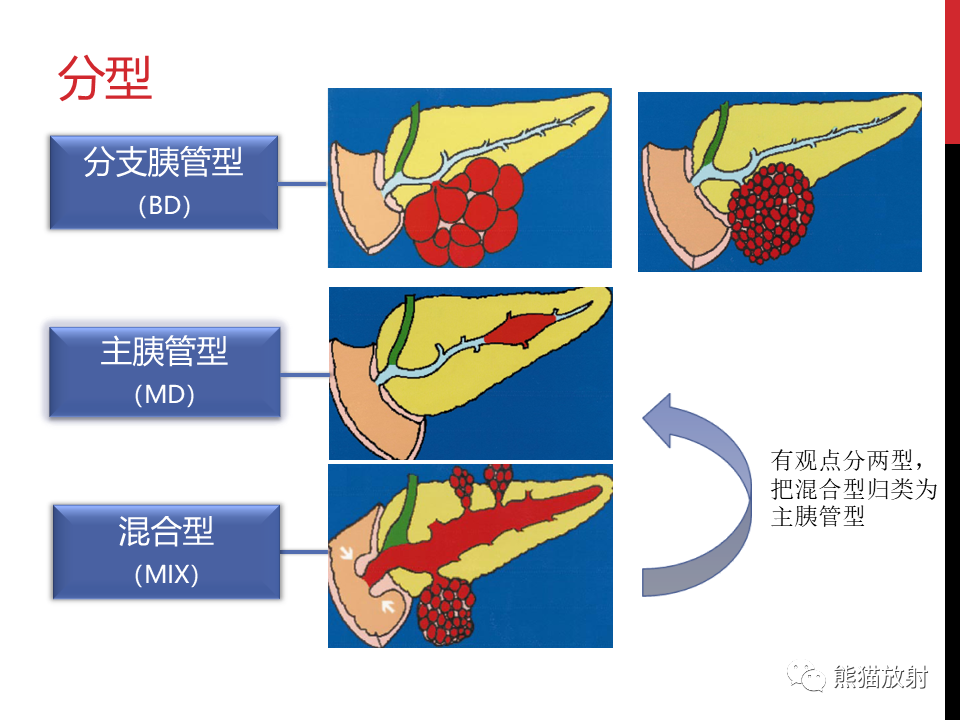 影像PPT - 【PPT】胰腺导管内肿瘤的影像诊断-12