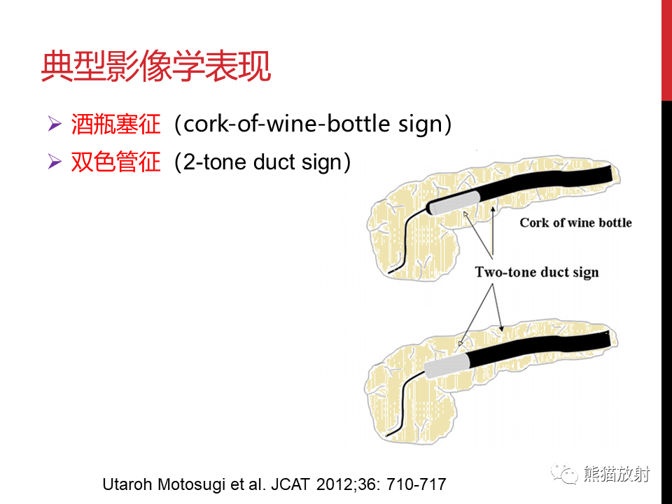 影像PPT - 【PPT】胰腺导管内肿瘤的影像诊断-28