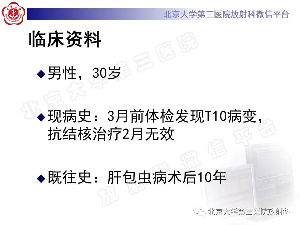 影像PPT - 【PPT】骨包虫病-2