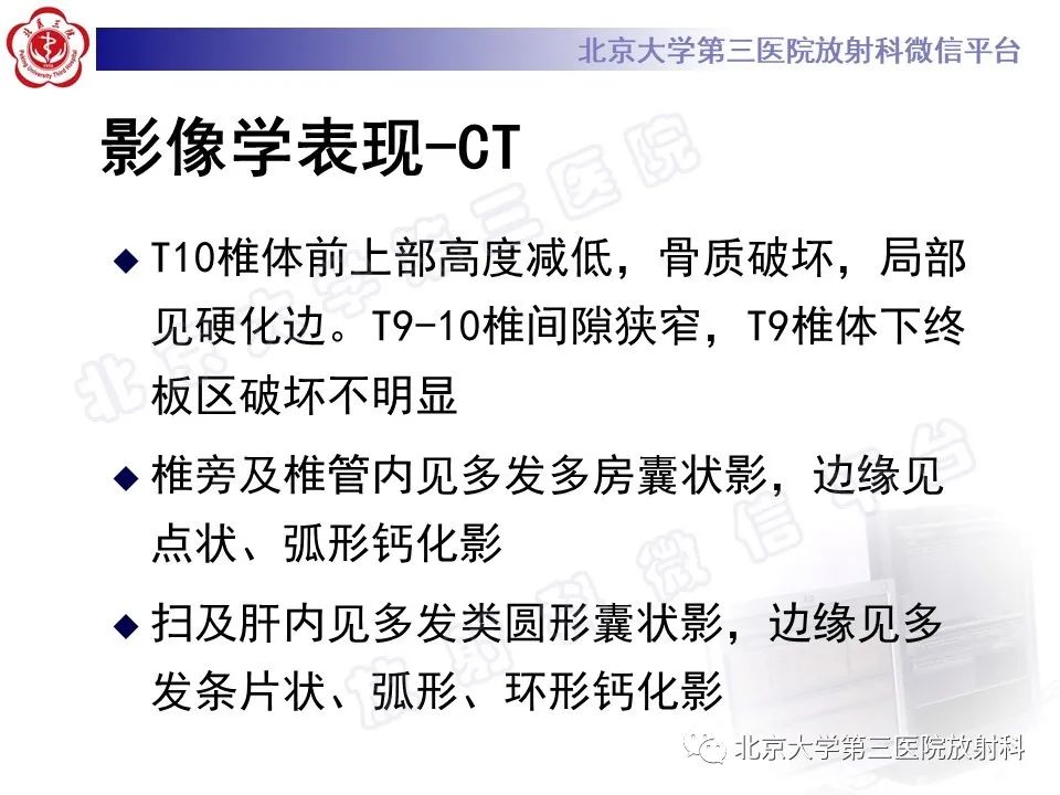 影像PPT - 【PPT】骨包虫病-7