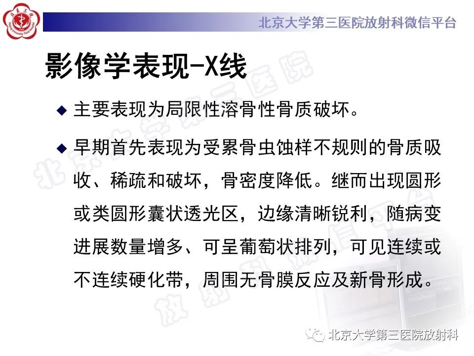 影像PPT - 【PPT】骨包虫病-17