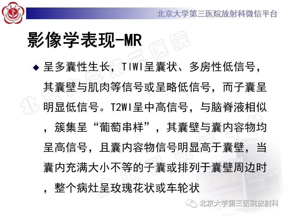 影像PPT - 【PPT】骨包虫病-24