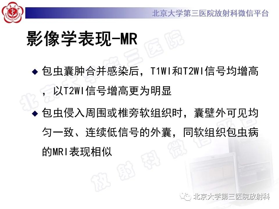 影像PPT - 【PPT】骨包虫病-25