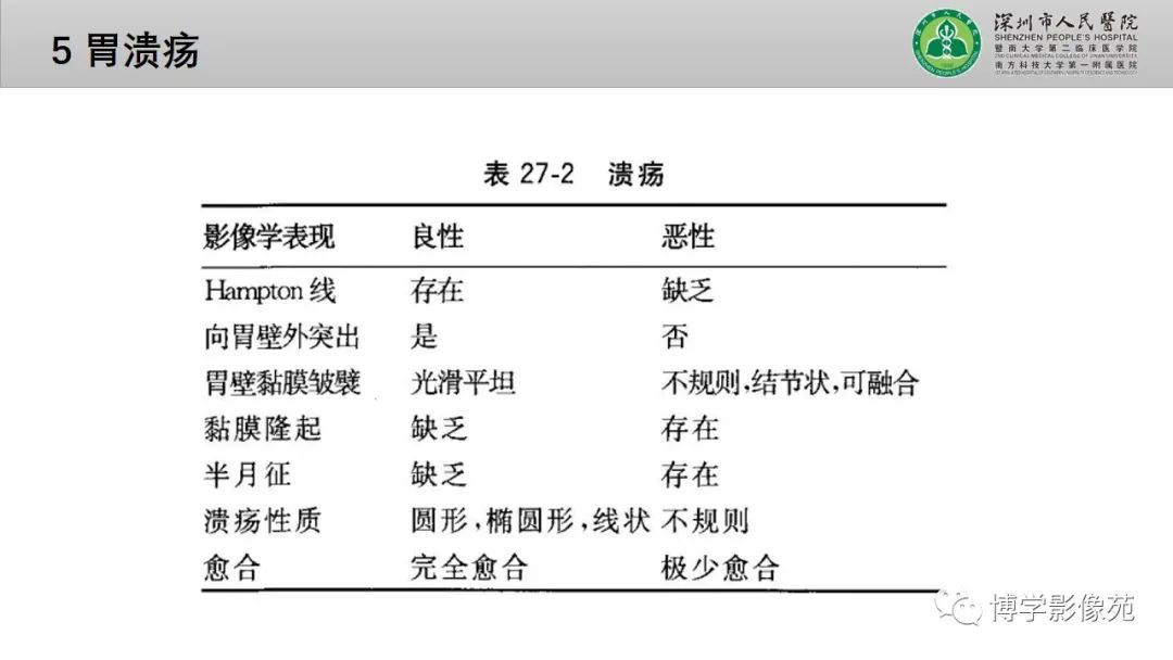 影像PPT - 【PPT】核心放射学读书报告—胃和大肠-26