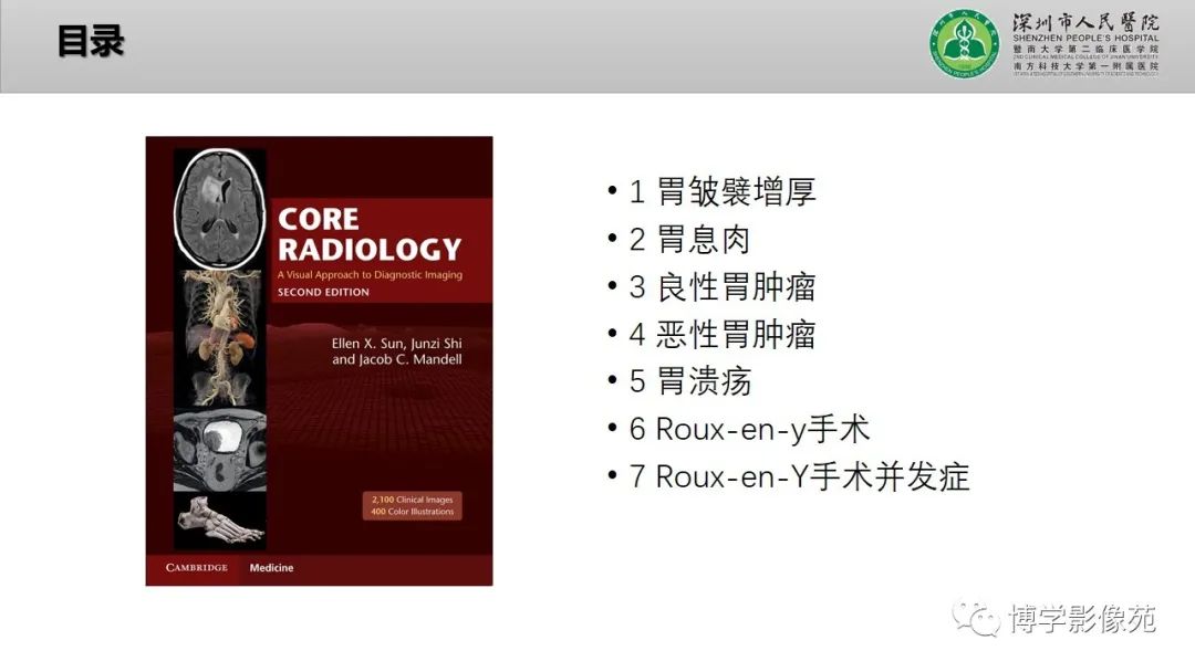 影像PPT - 【PPT】核心放射学读书报告—胃和大肠-2