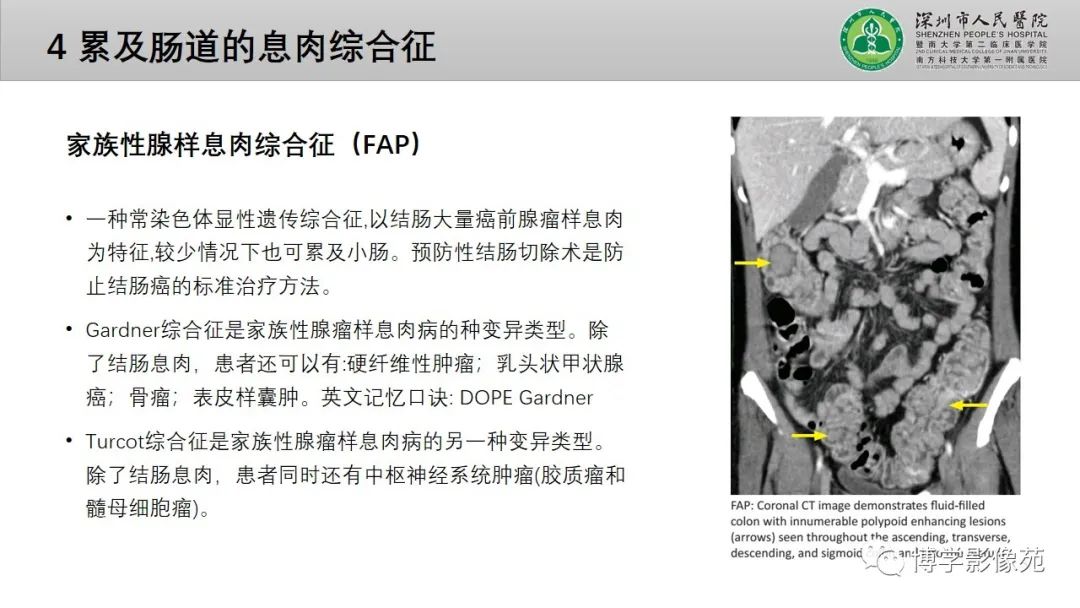影像PPT - 【PPT】核心放射学读书报告—胃和大肠-47