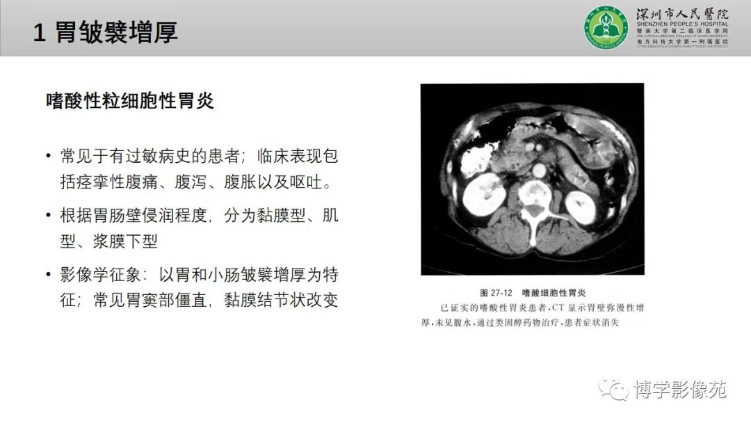 影像PPT - 【PPT】核心放射学读书报告—胃和大肠-5