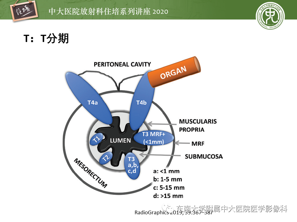 影像PPT - 【PPT】直肠癌影像临床分期注意事项-8