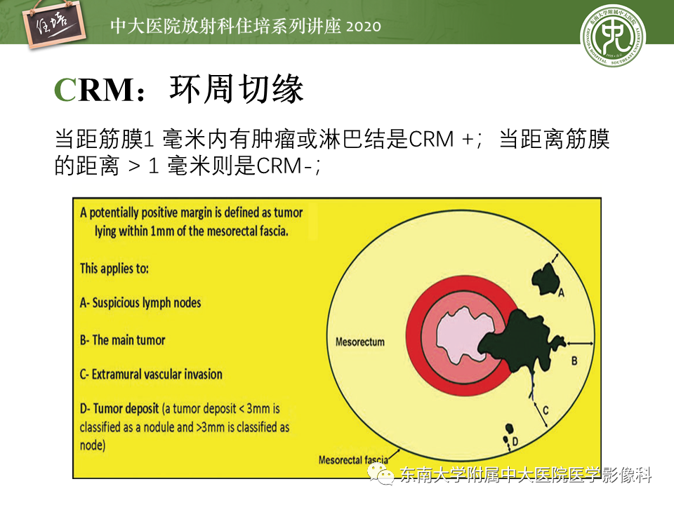 影像PPT - 【PPT】直肠癌影像临床分期注意事项-17