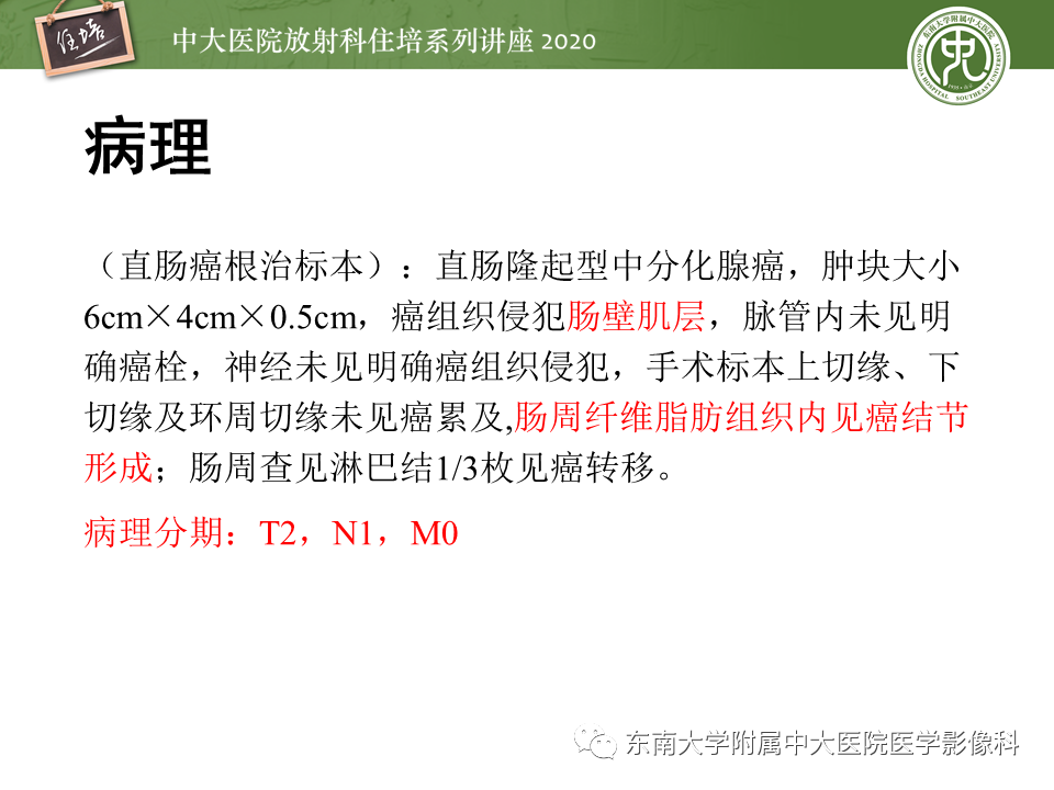 影像PPT - 【PPT】直肠癌影像临床分期注意事项-23