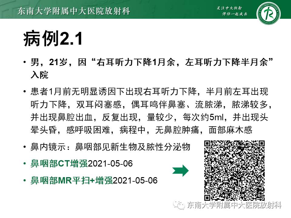 影像PPT - 【PPT】鼻咽部占位性病变随访及鉴别-14