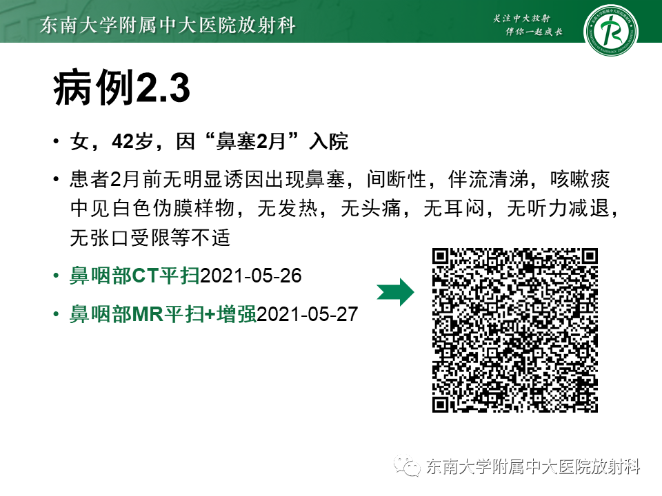 影像PPT - 【PPT】鼻咽部占位性病变随访及鉴别-25