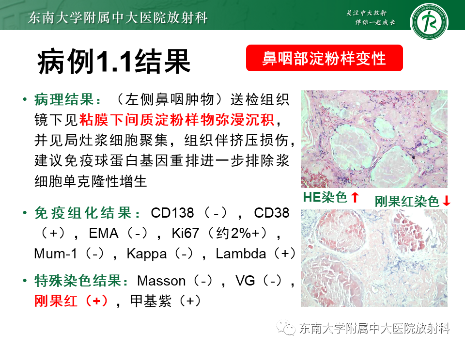 影像PPT - 【PPT】鼻咽部占位性病变随访及鉴别-32