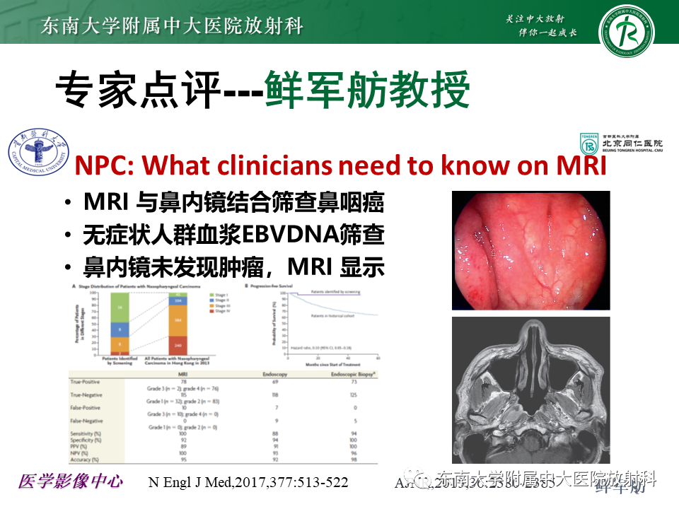 影像PPT - 【PPT】鼻咽部占位性病变随访及鉴别-38
