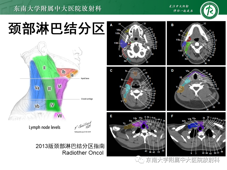 影像PPT - 【PPT】鼻咽部占位性病变随访及鉴别-60