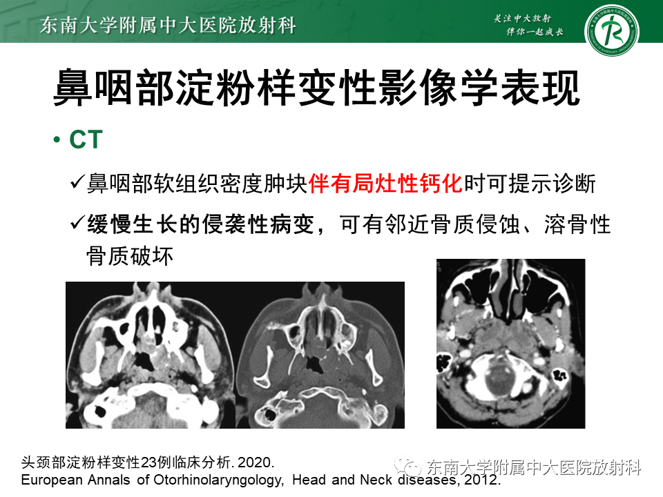 影像PPT - 【PPT】鼻咽部占位性病变随访及鉴别-65