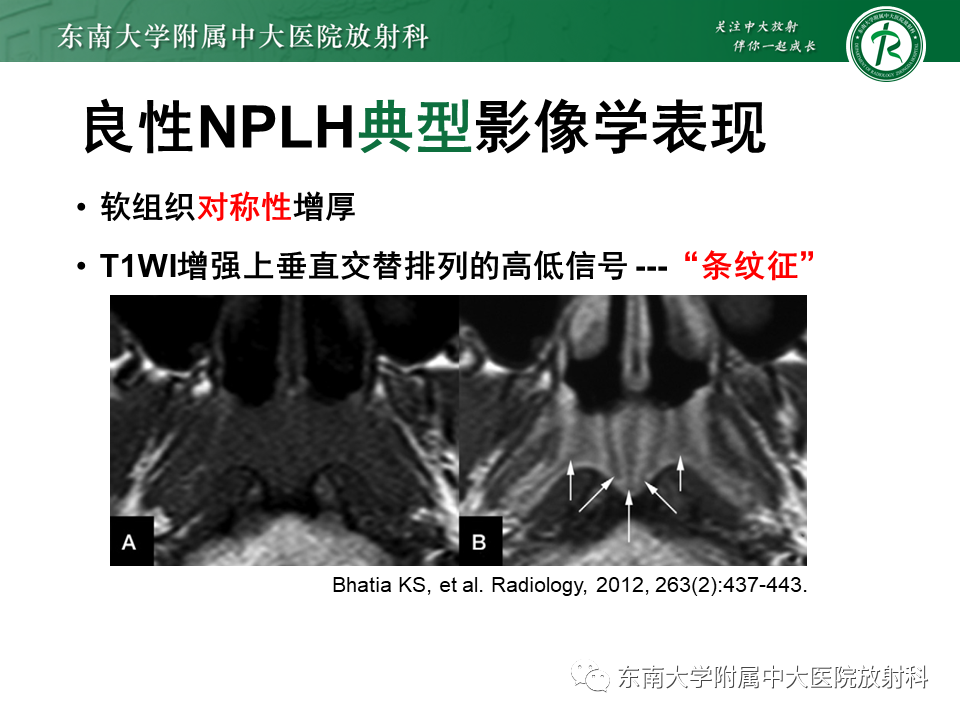影像PPT - 【PPT】鼻咽部占位性病变随访及鉴别-70