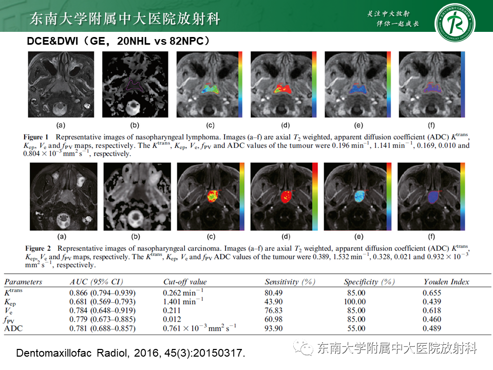 影像PPT - 【PPT】鼻咽部占位性病变随访及鉴别-83