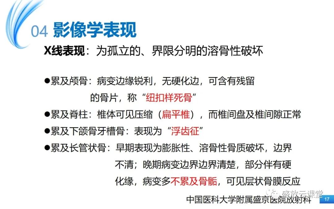 影像PPT - 【PPT】骨嗜酸性肉芽肿-17