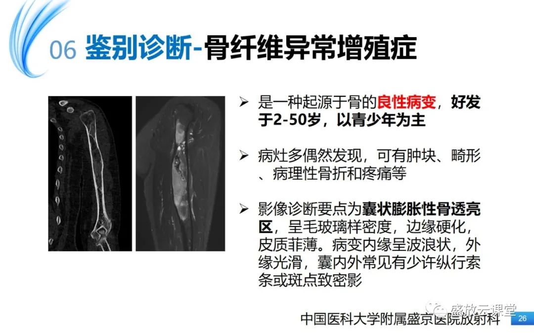 影像PPT - 【PPT】骨嗜酸性肉芽肿-26