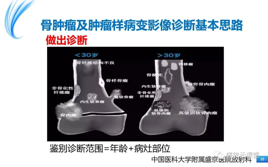 影像PPT - 【PPT】骨嗜酸性肉芽肿-38