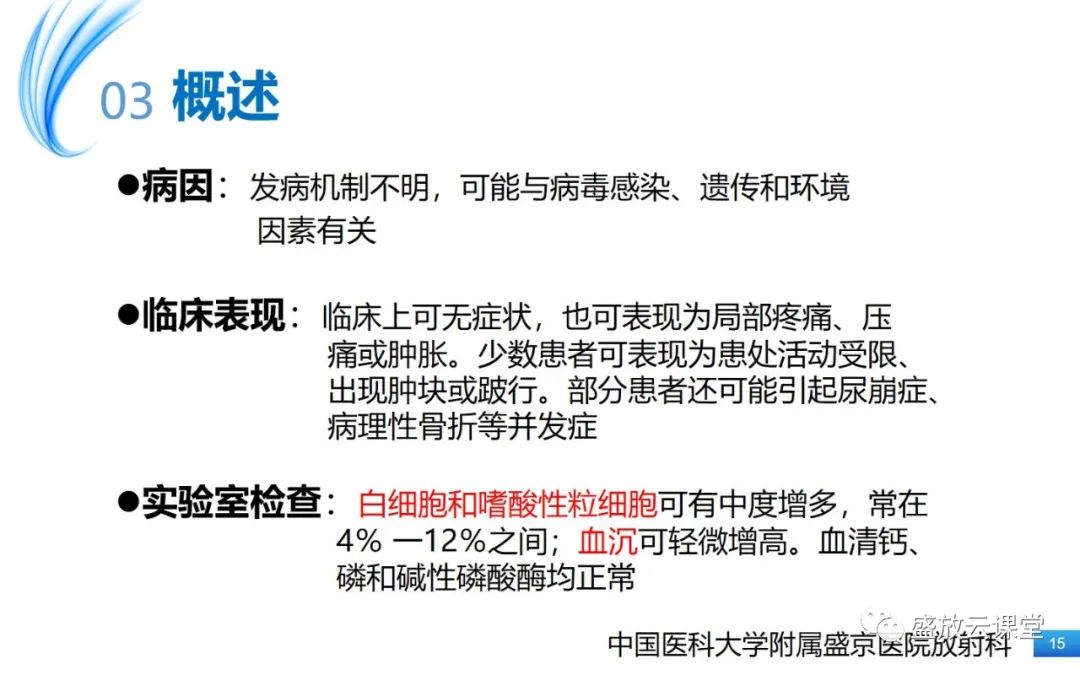 影像PPT - 【PPT】骨嗜酸性肉芽肿-15