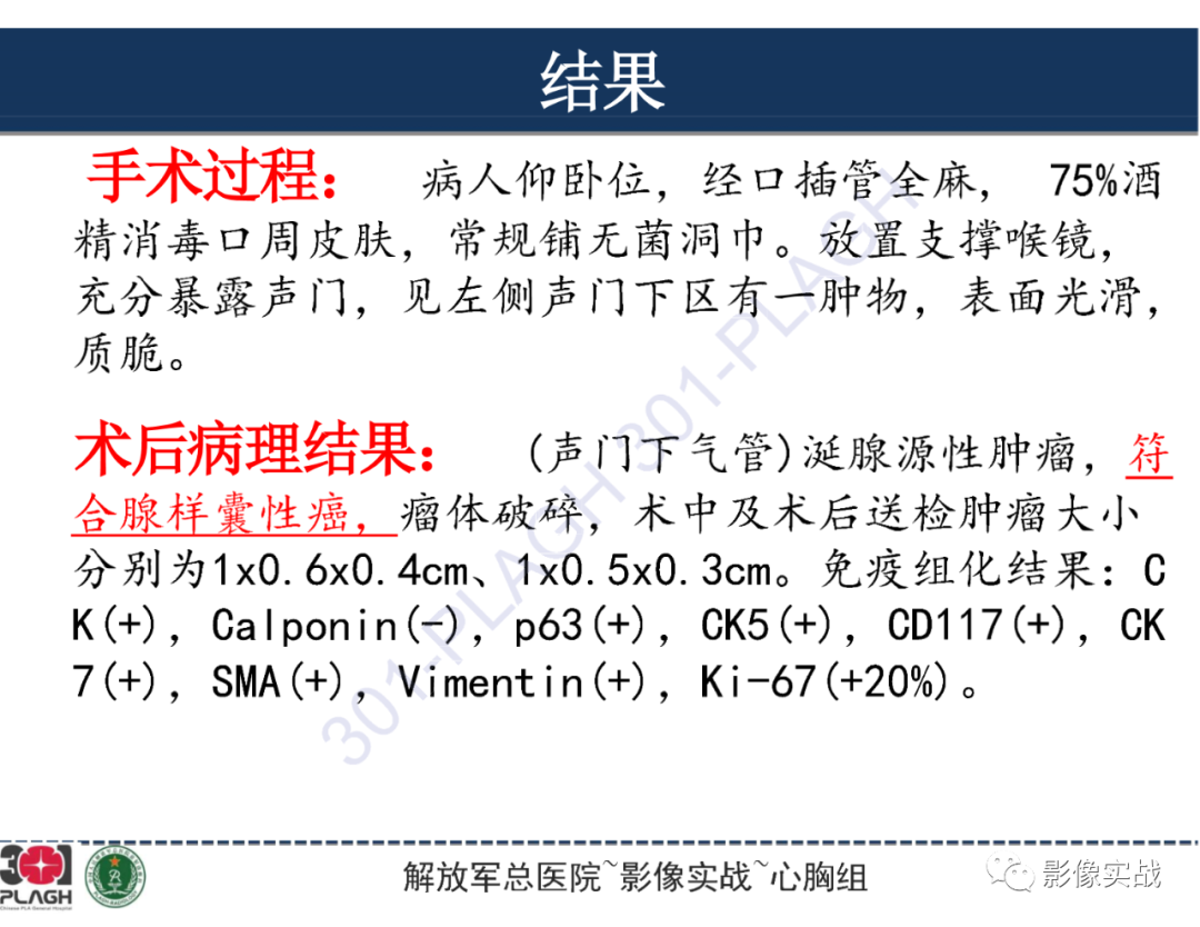 影像PPT - 【病例】气管腺样囊性癌1例CT及MR-32