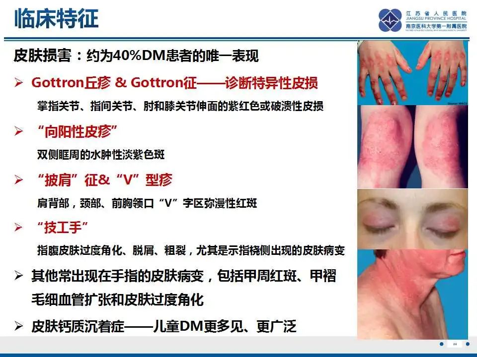 影像PPT - 【PPT】皮肌炎-21