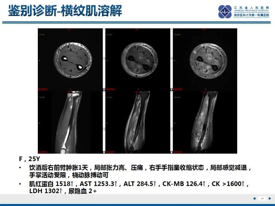 影像PPT - 【PPT】皮肌炎-34