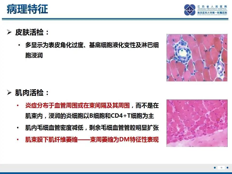 影像PPT - 【PPT】皮肌炎-19