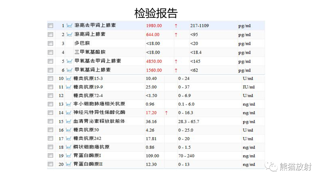 影像PPT - 【病例】节细胞神经瘤 VS 副神经节瘤-12
