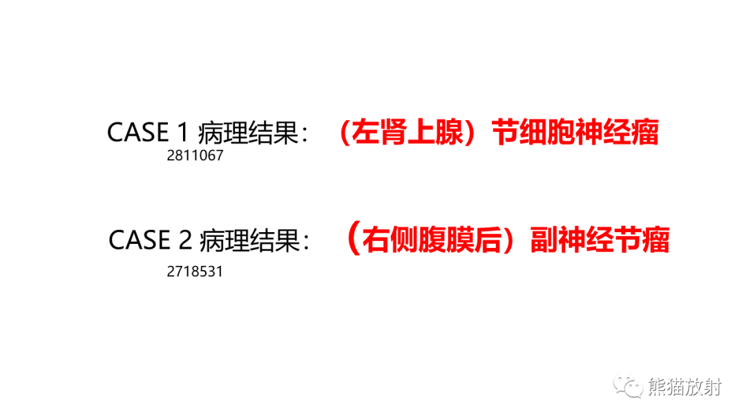 影像PPT - 【病例】节细胞神经瘤 VS 副神经节瘤-19