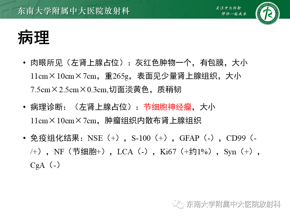 影像PPT - 【PPT】肾上腺神经源性肿瘤-15