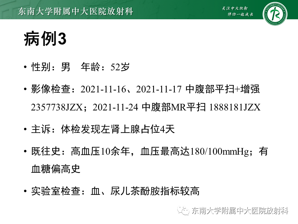 影像PPT - 【PPT】肾上腺神经源性肿瘤-23