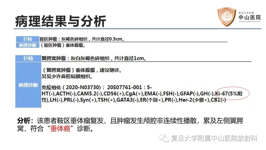 影像PPT - 【病例】垂体癌1例CT及MR影像-8