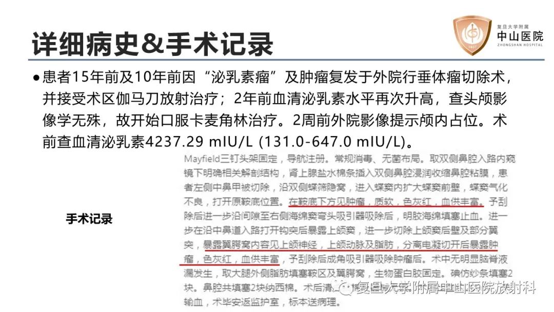 影像PPT - 【病例】垂体癌1例CT及MR影像-7