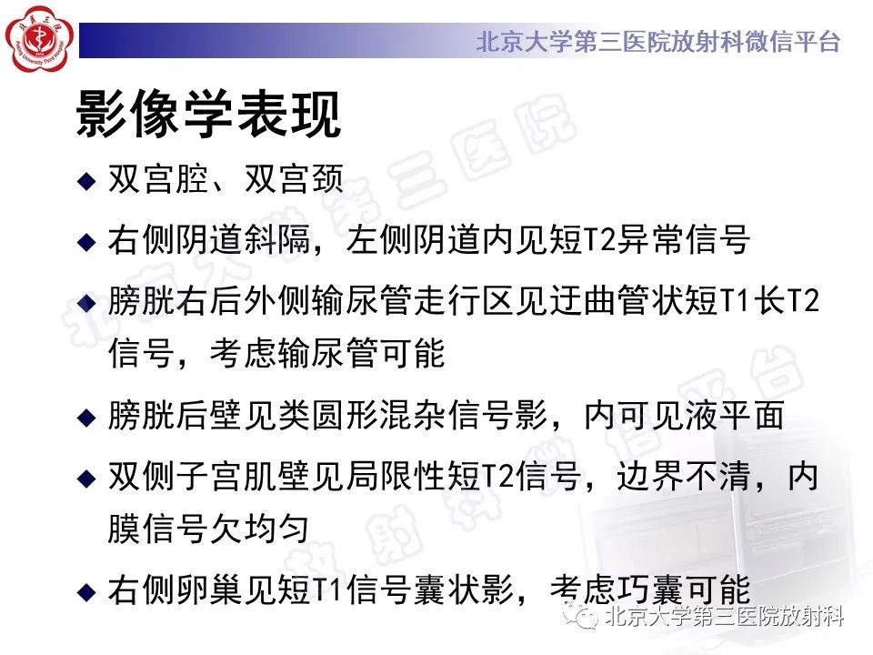 影像PPT - 【PPT】阴道斜隔综合征-9