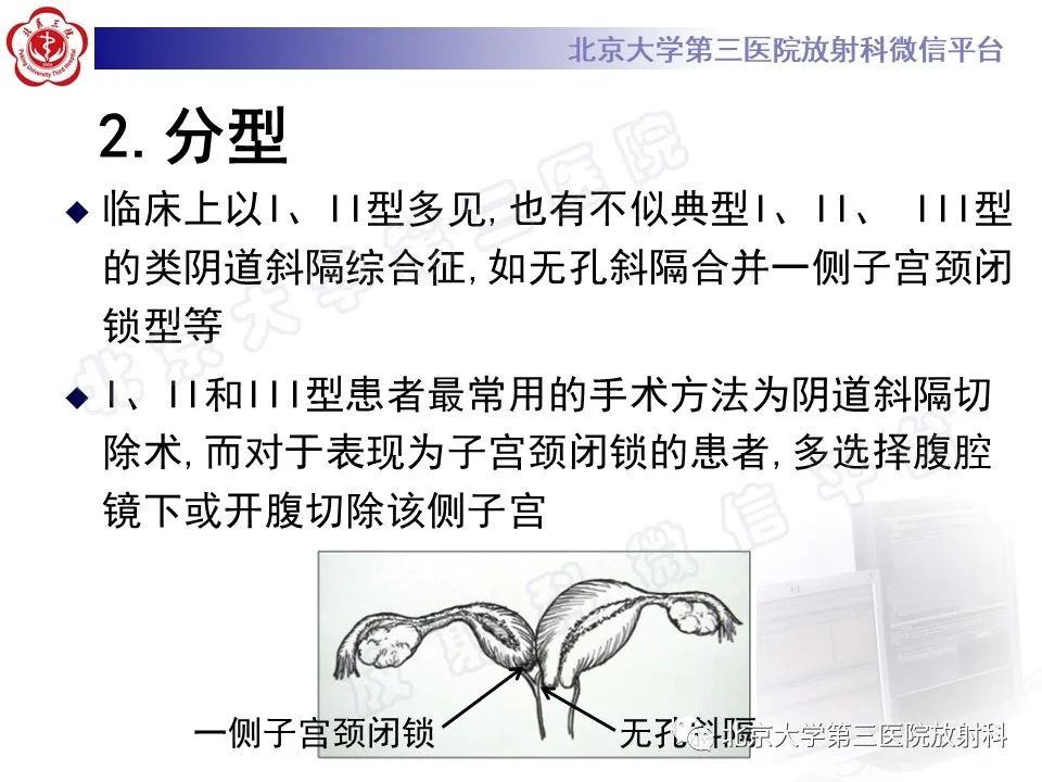 影像PPT - 【PPT】阴道斜隔综合征-22
