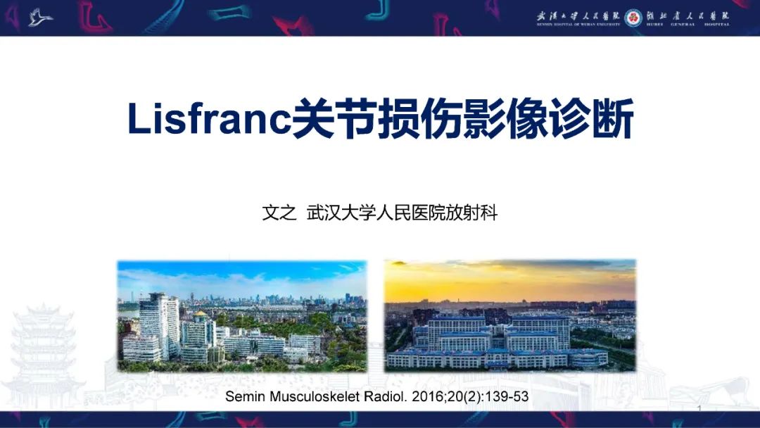 影像PPT - 【PPT】Lisfranc关节损伤影像诊断-1