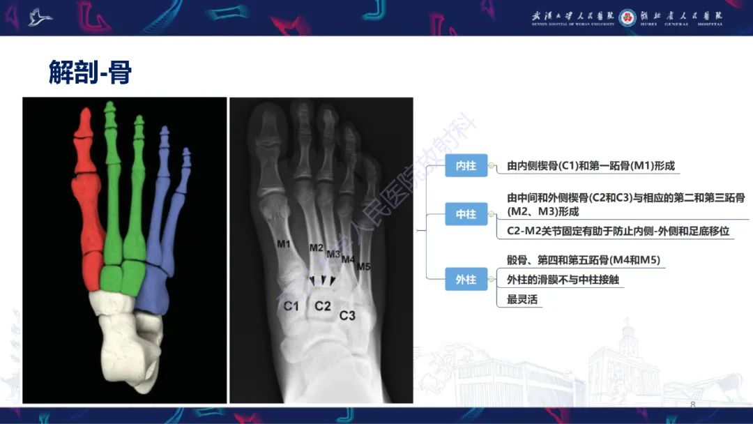 影像PPT - 【PPT】Lisfranc关节损伤影像诊断-8