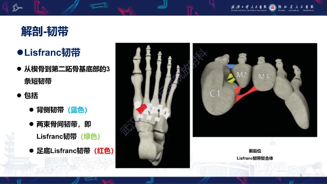 影像PPT - 【PPT】Lisfranc关节损伤影像诊断-9